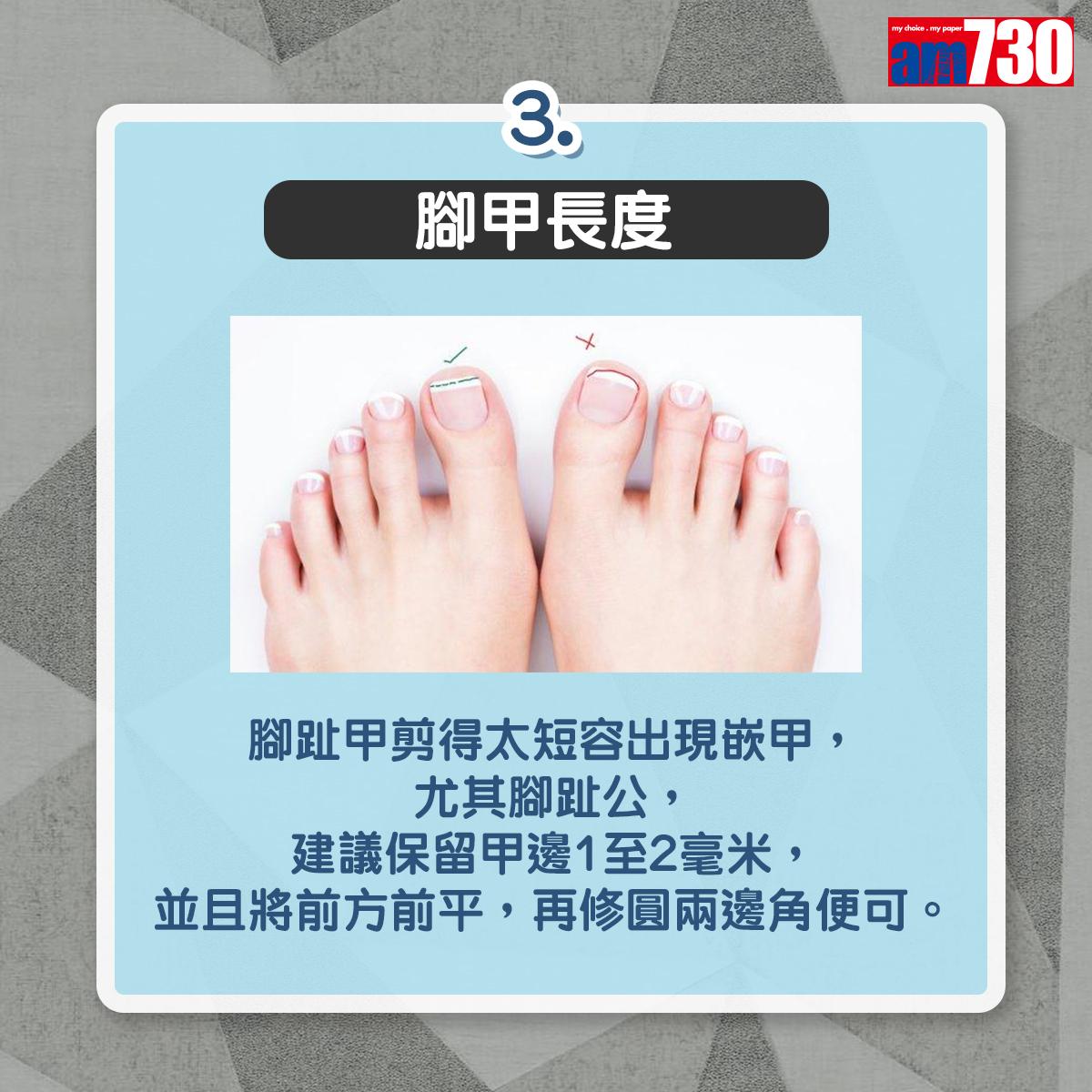 剪指甲/剪腳甲|正確剪指甲要點