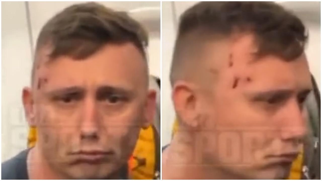 男子向鏡頭展示傷痕。(Twitter)