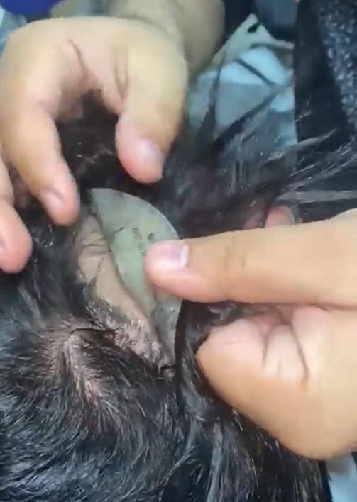 秃頭藏黃金。(Twitter)