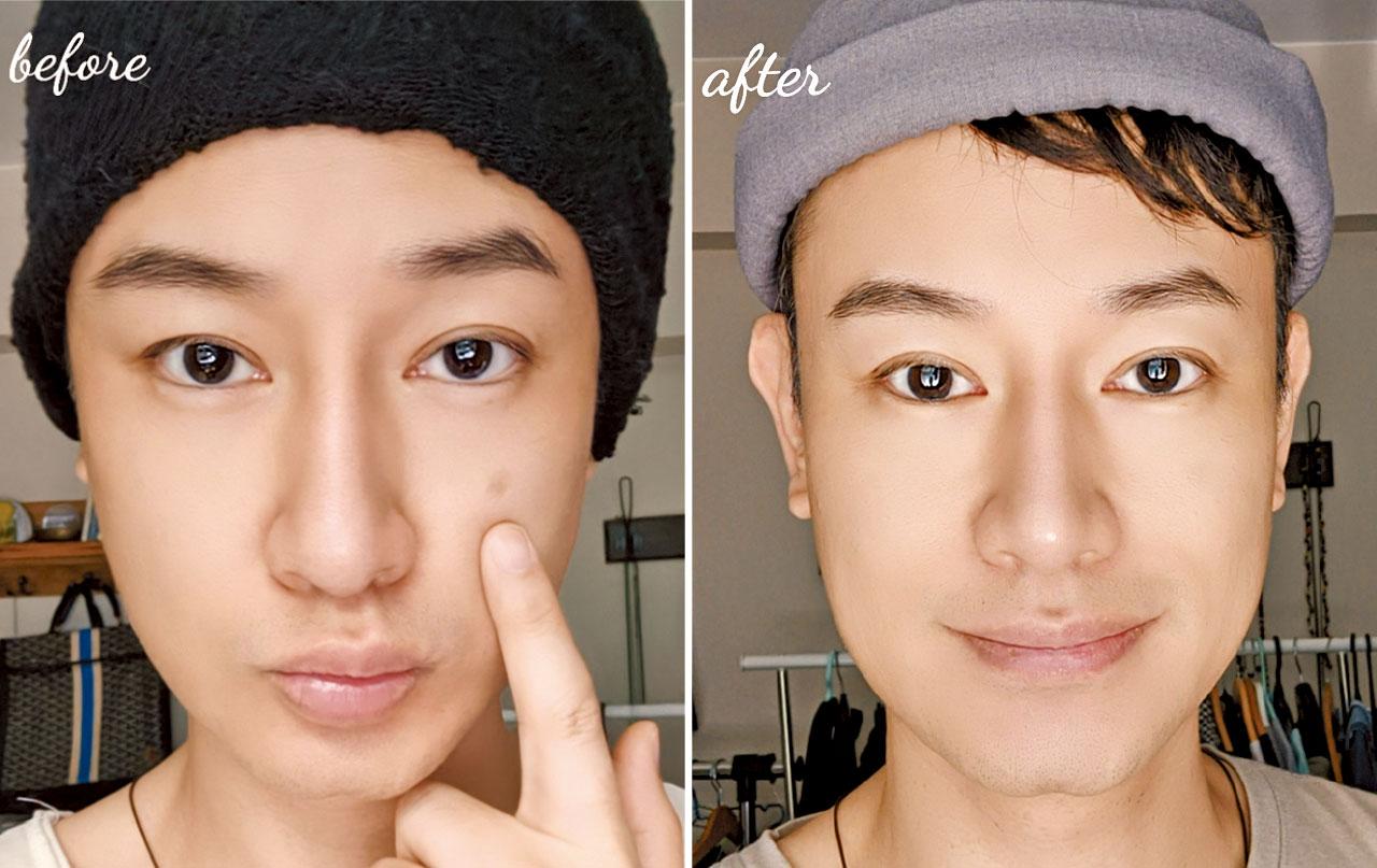 黑斑請你遠離我!