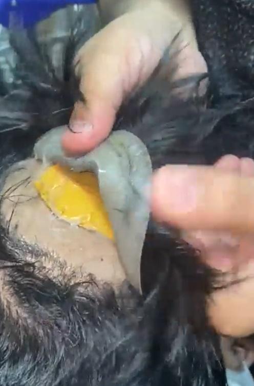 秃頭藏黃金。(Twitter)