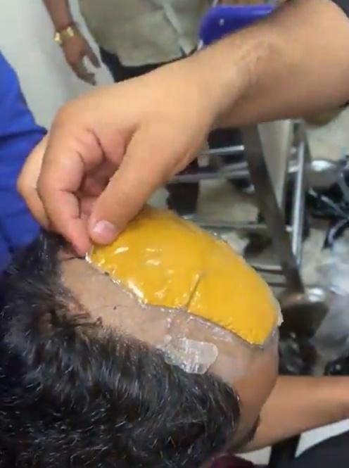 秃頭藏黃金。(Twitter)