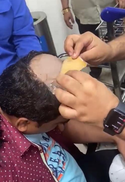 秃頭藏黃金。(Twitter)