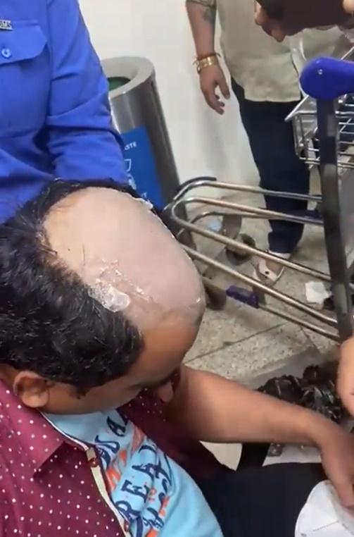 秃頭藏黃金。(Twitter)