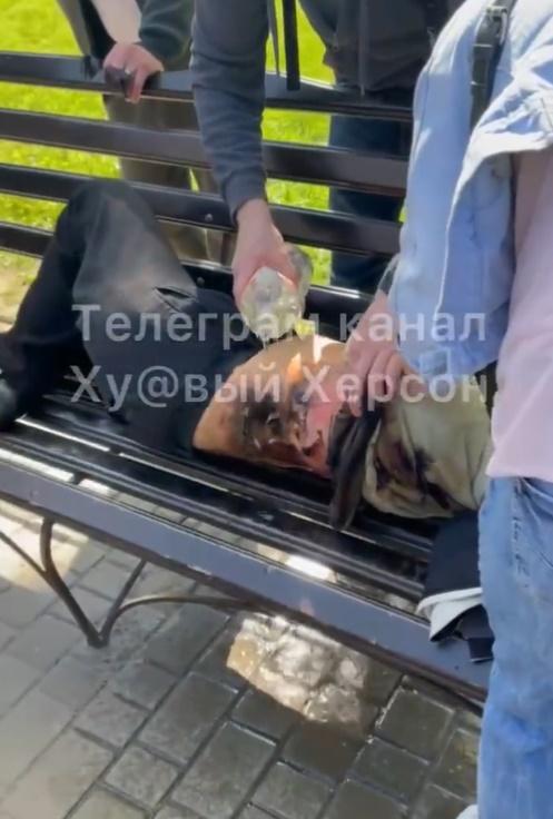 有人腰部皮開肉綻,疑遭受炸傷。(Twitter)