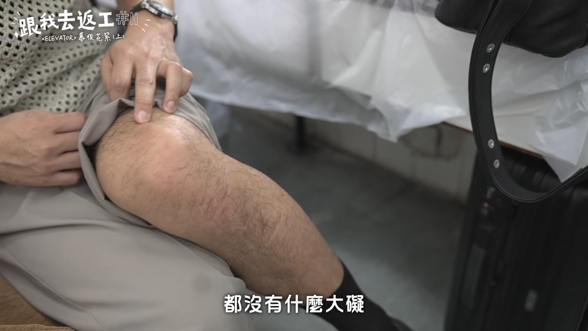 Edan露出「毛腿」表示,吊威也稍為撞瘀無大礙。(截圖)