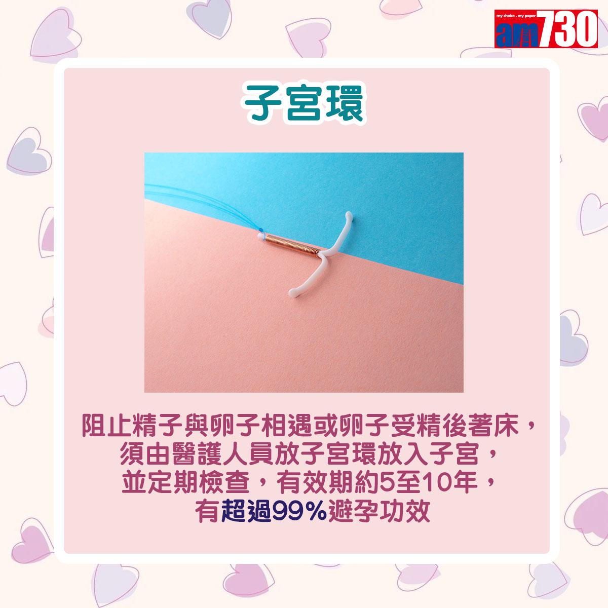 子宮環:阻止精子與卵子相遇或卵子受精後著床,須由醫護人員放子宮環放入子宮,並定期檢查,有效期約5至10年,有超過99%避孕功效。