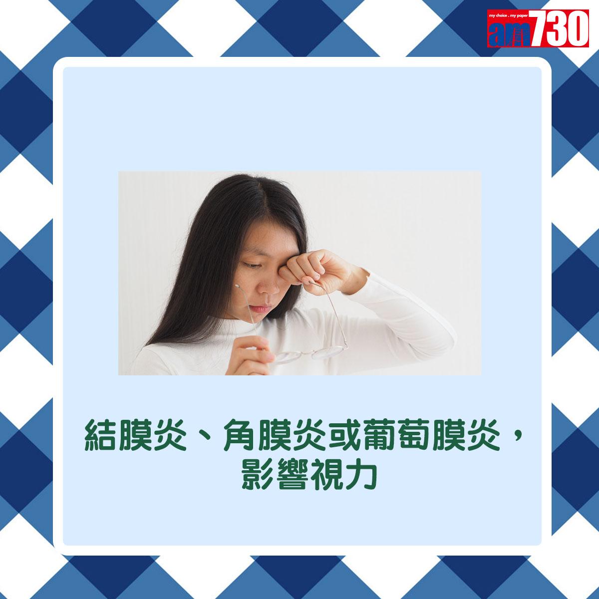 結膜炎、角膜炎或葡萄膜炎,影響視力