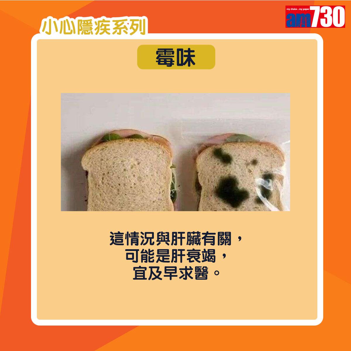 小便|尿味異常或因糖尿病或腎衰竭等疾病(am730製圖)