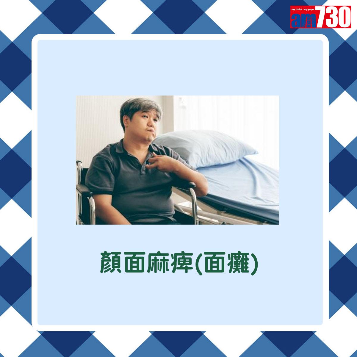 顏面麻痺(面癱)