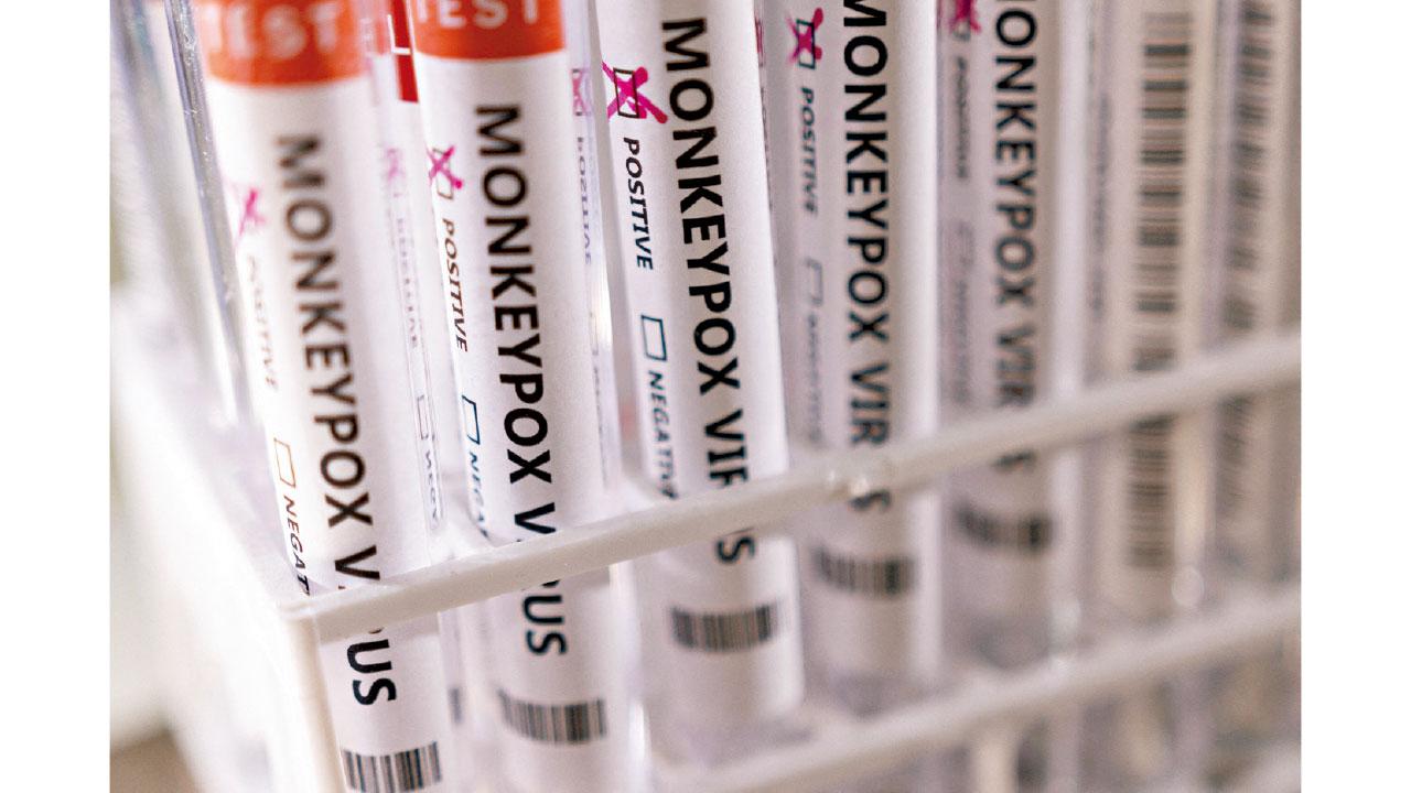 歐洲爆發|捷克斯洛文尼首確診 英國單日增37宗猴痘