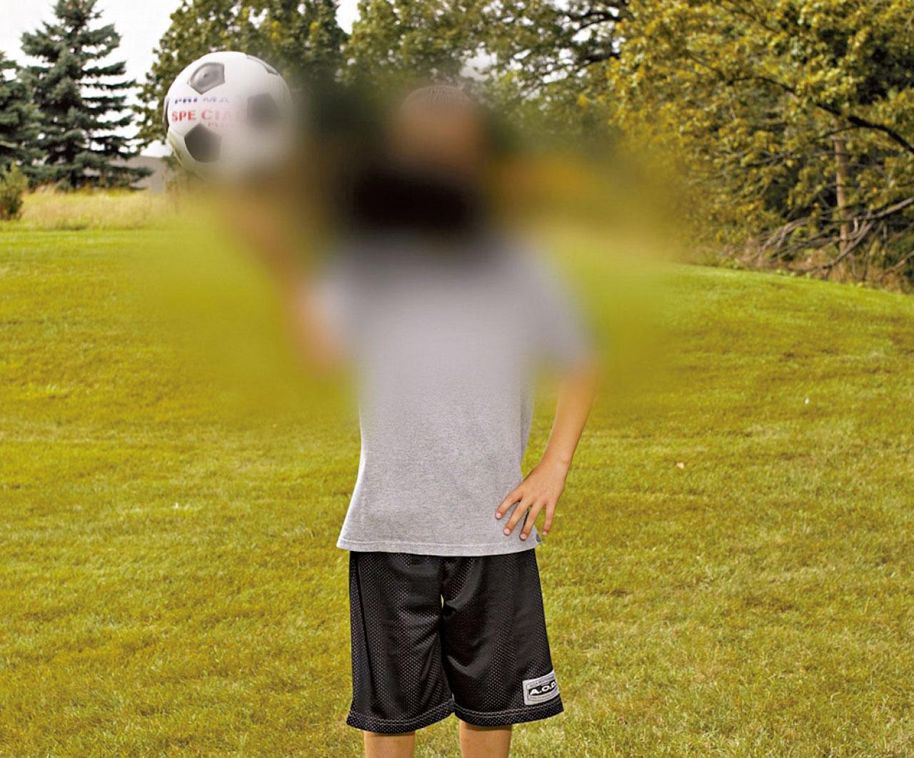 老年黃斑病變 藥物資助籲積極治療