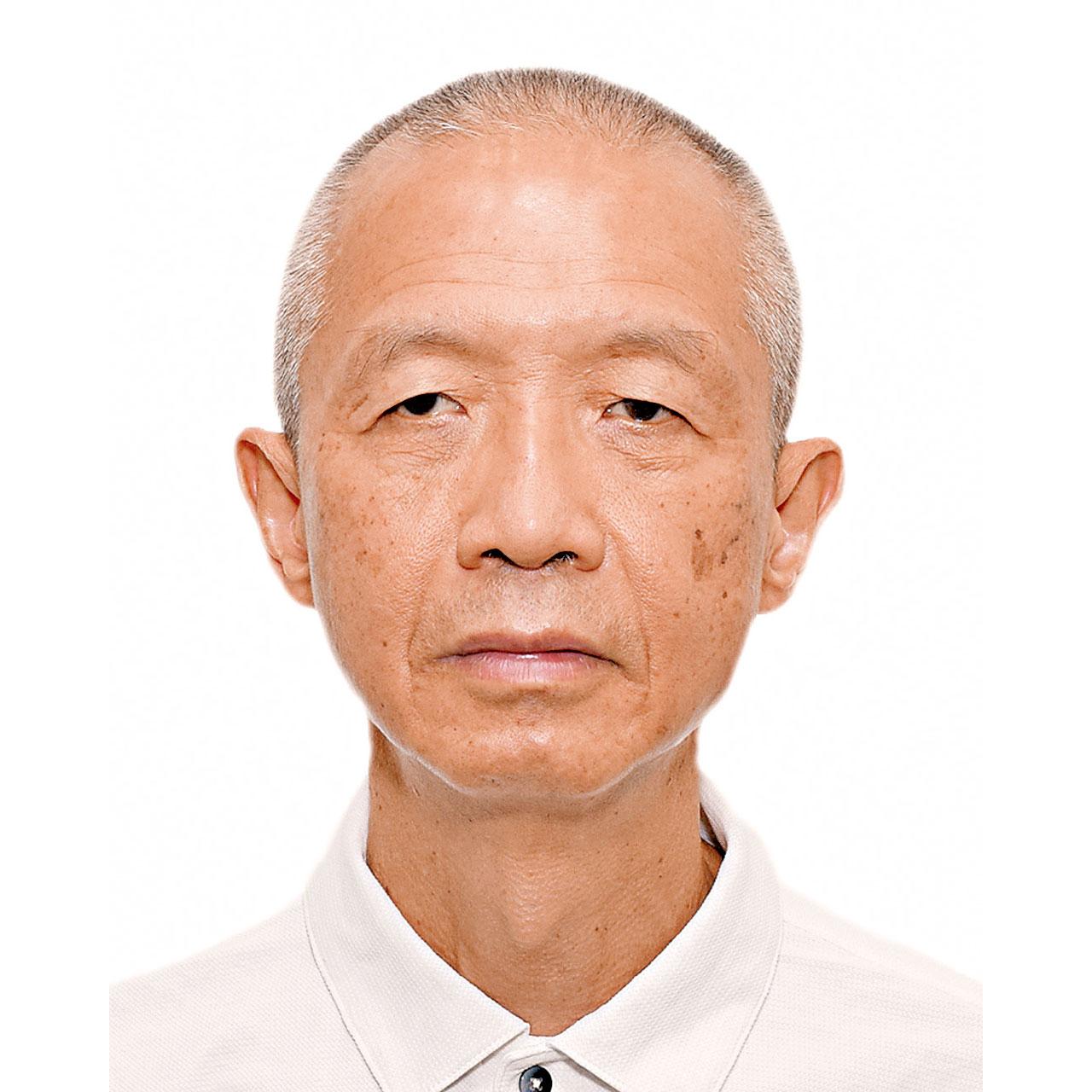 老年黃斑病變 藥物資助籲積極治療