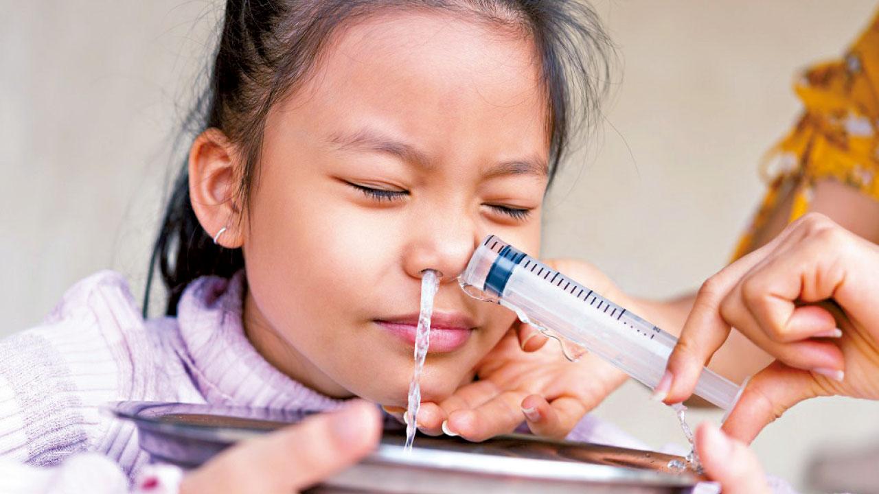 可大可小|擠爆鼻內膿瘡致顱內感染 深圳愛撩鼻少女險死