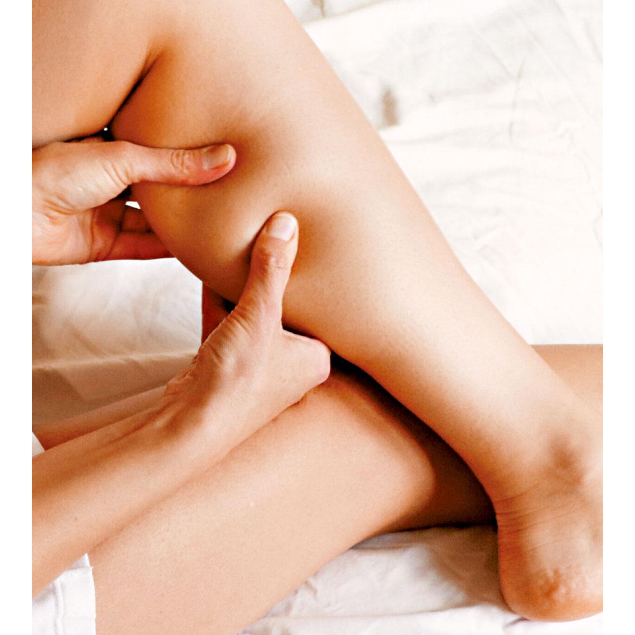 靜脈曲張 隨時皮膚潰爛