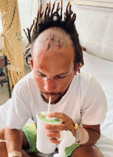 Joshua Young展示傷疤。(網上圖片)