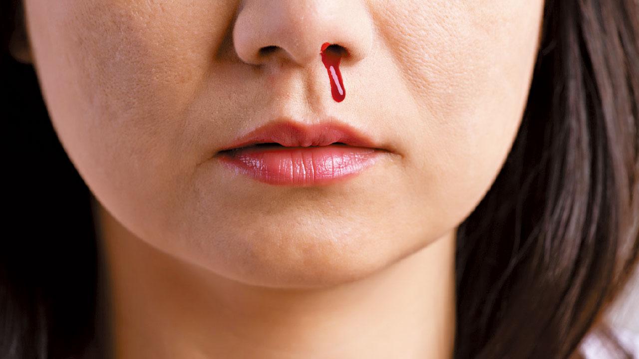 鼻咽癌 治療新方向