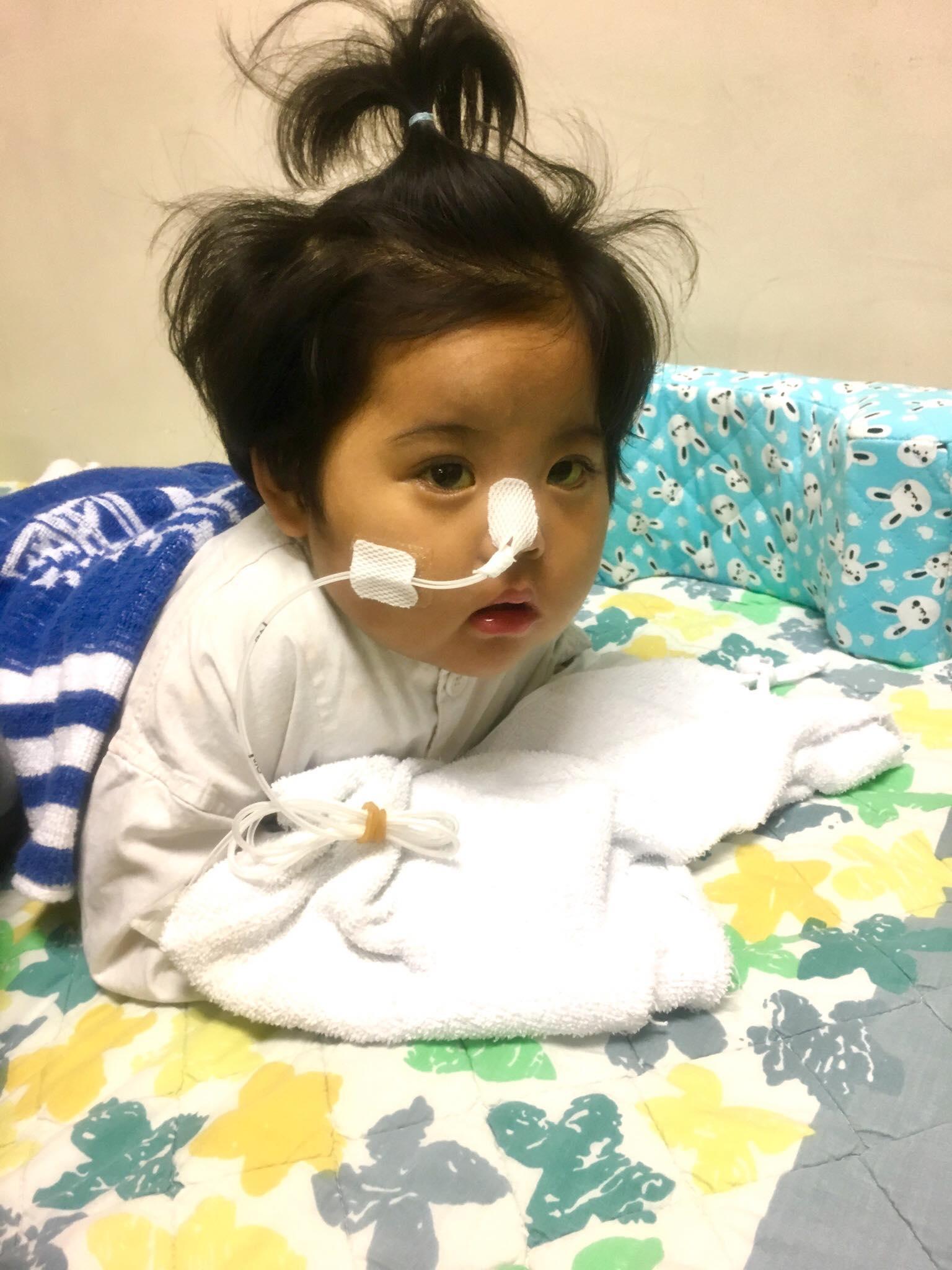 小予恩手術後心跳呼吸一度停頓