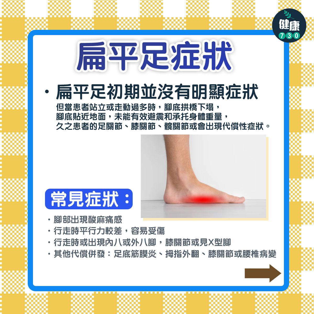 扁平足症狀