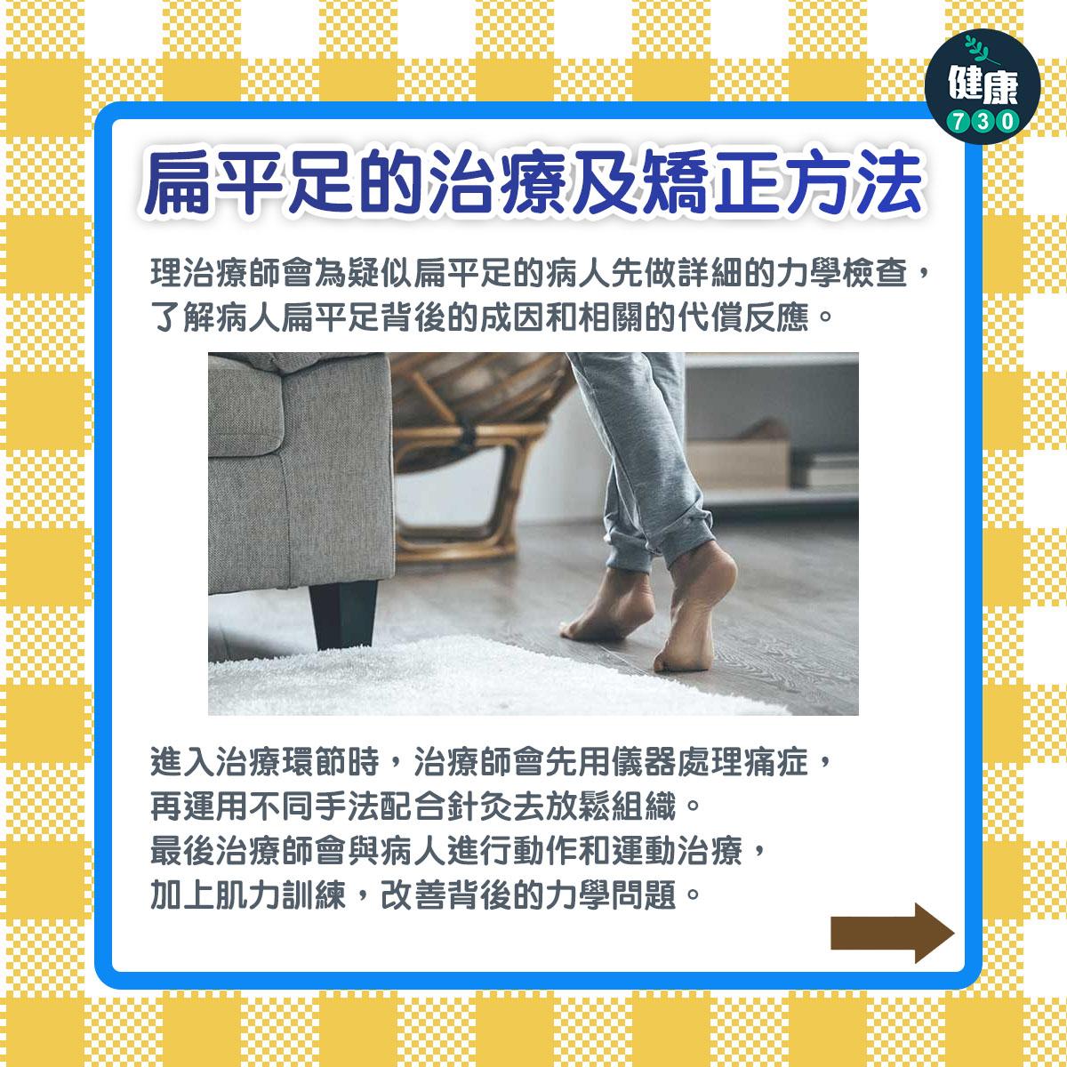 扁平足的治療及矯正方法1