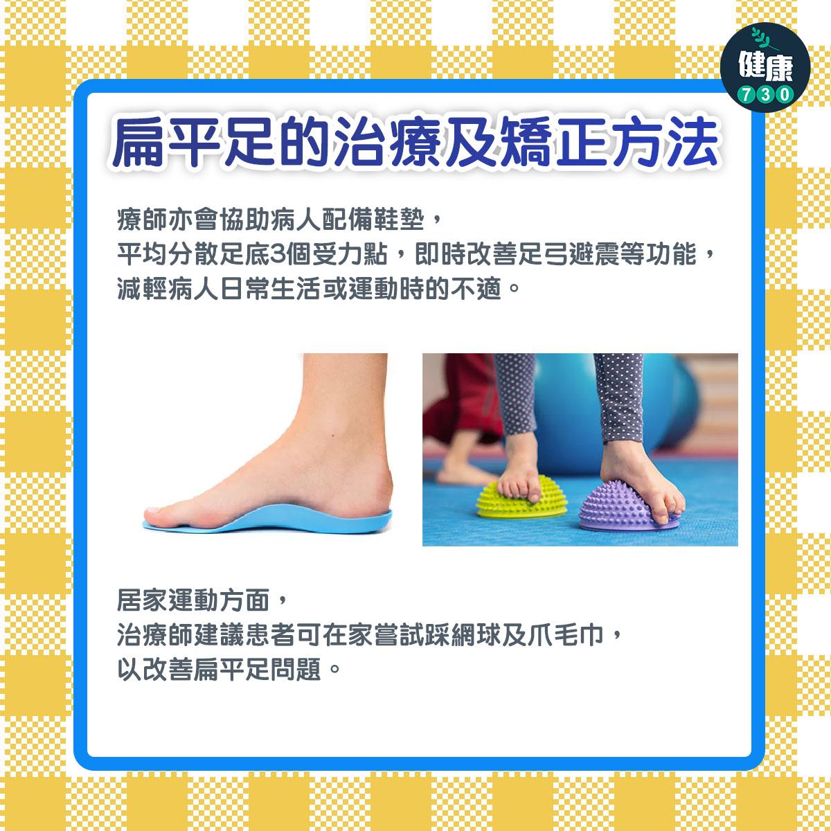 扁平足的治療及矯正方法2