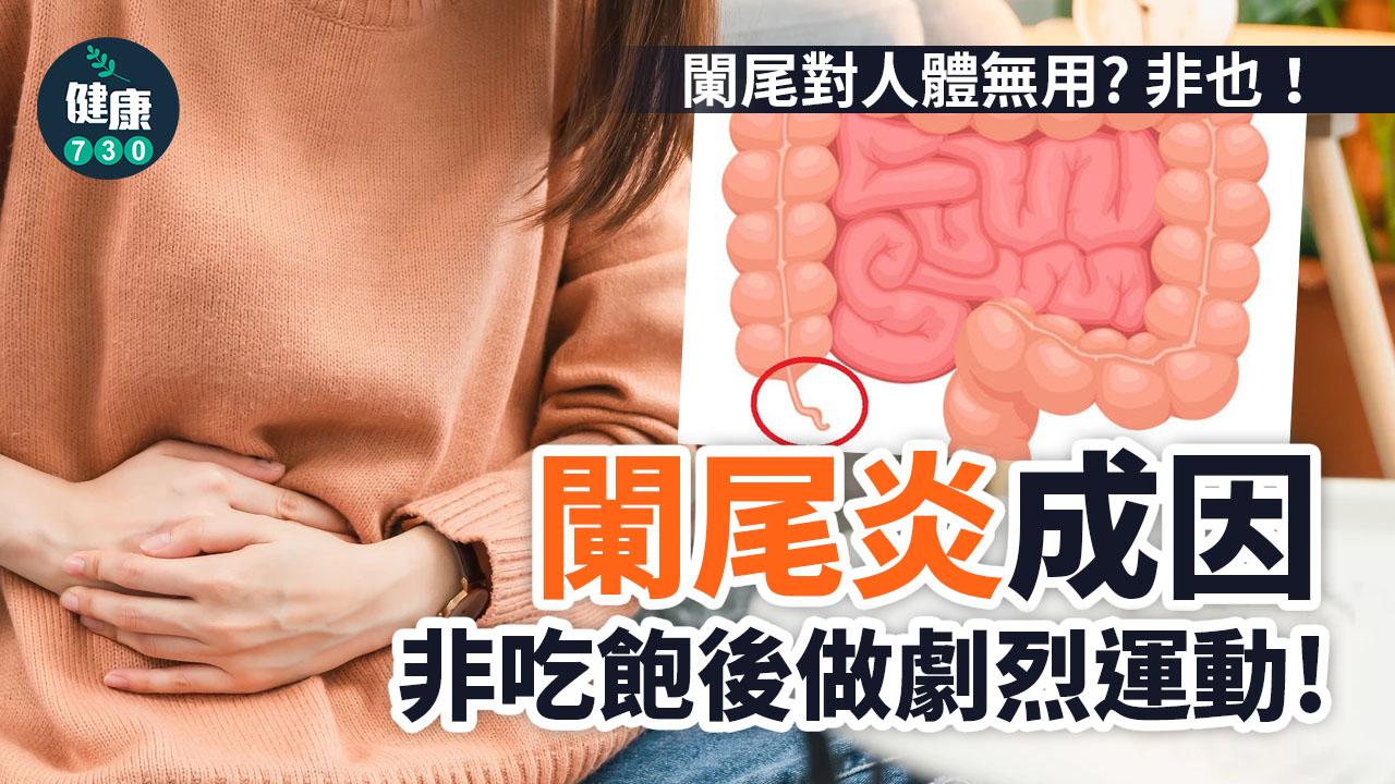 盲腸炎原因|䦨尾炎症狀 施手術切咗就好?(am730製圖)