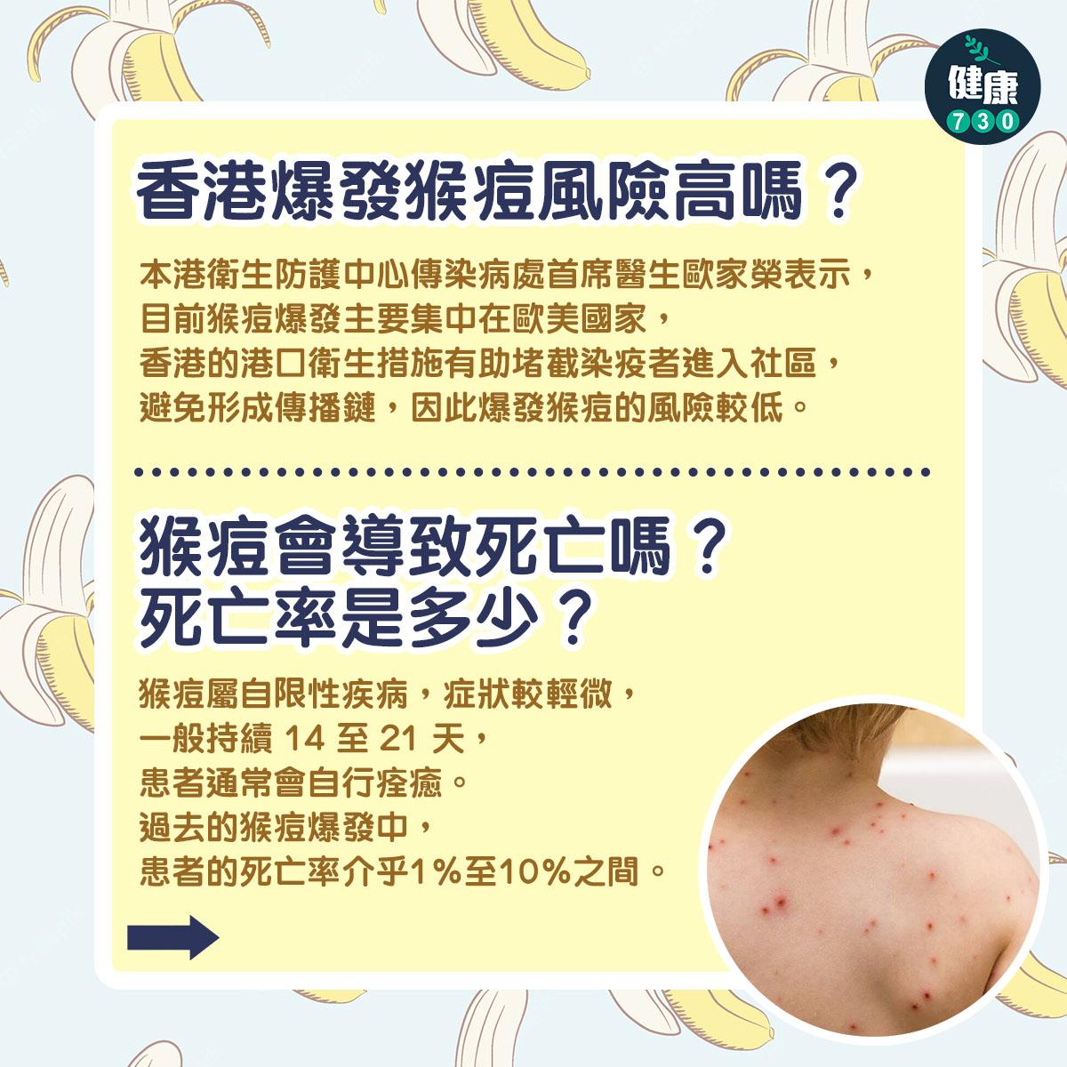 香港爆發猴痘風險高嗎?