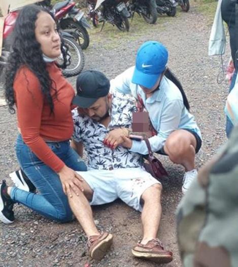 該名男子左臂被撕咬出許多傷口,包括上臂出現一個血洞。(Twitter)