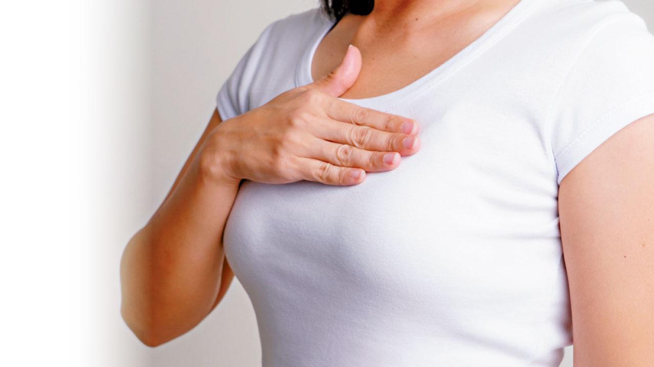 半數女性會患乳房良性腫瘤?