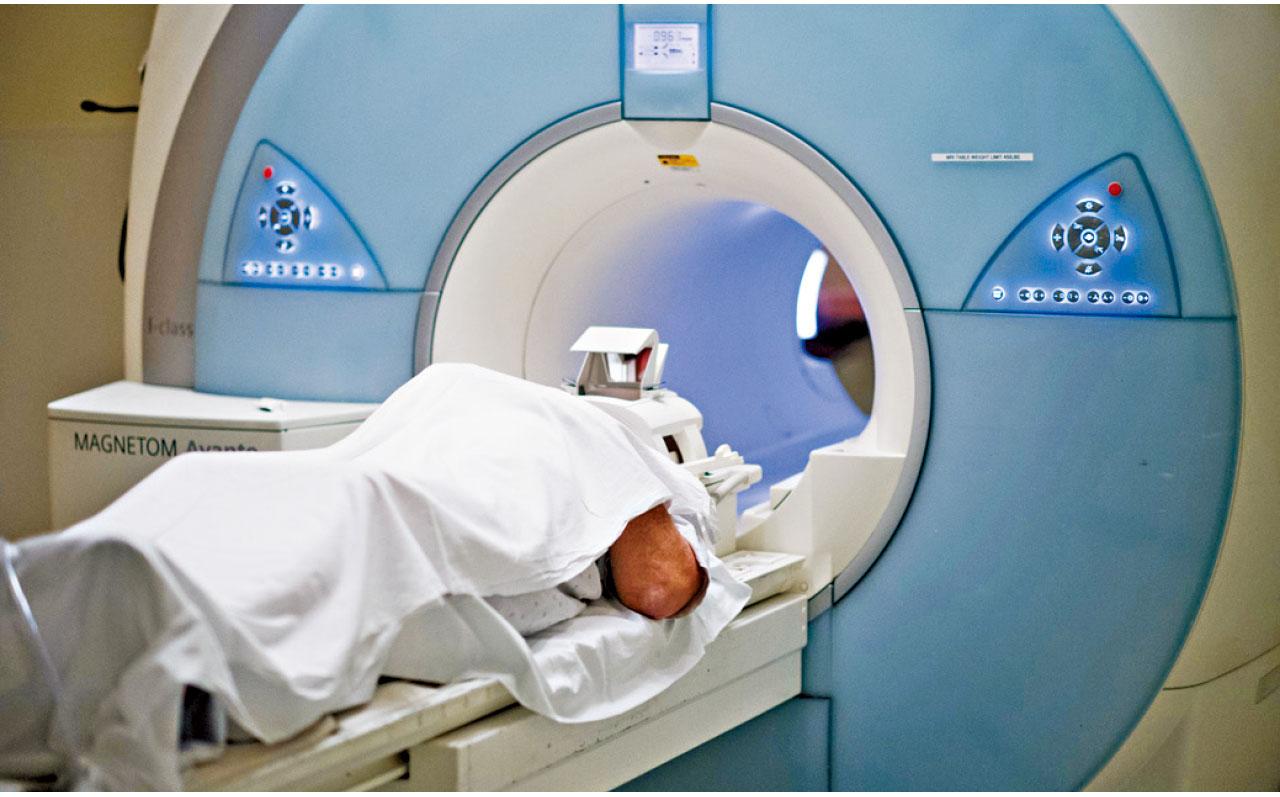 X染色體出事 法布瑞氏症可致心肌肥厚