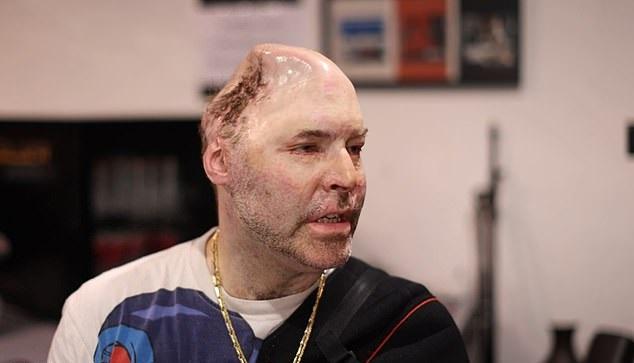 Brenne近日受訪憶述當年的意外。(互聯網)