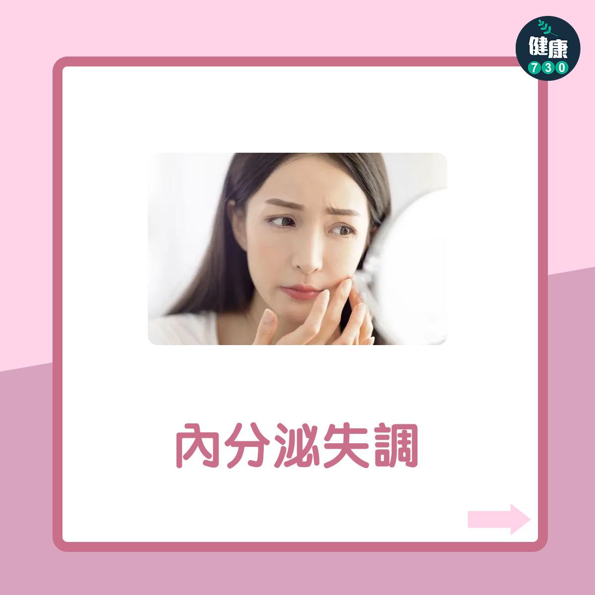 女性不育7大原因(am730製圖)