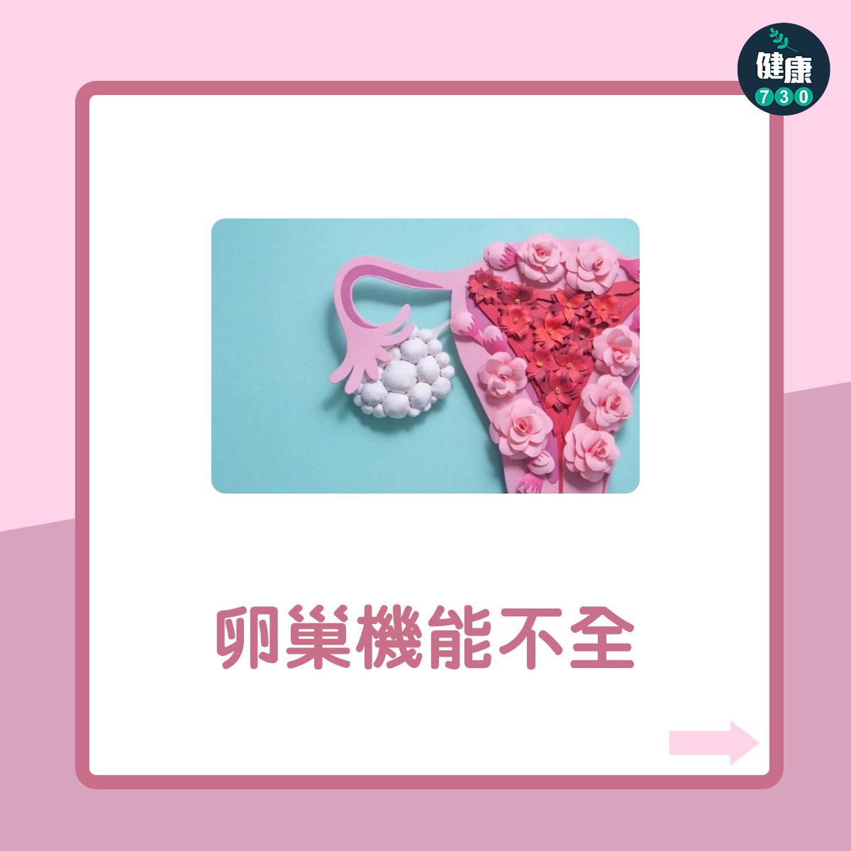 女性不育7大原因(am730製圖)