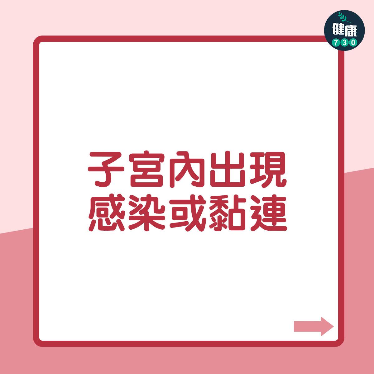 墮胎|終止懷孕後的影響(am730製圖)