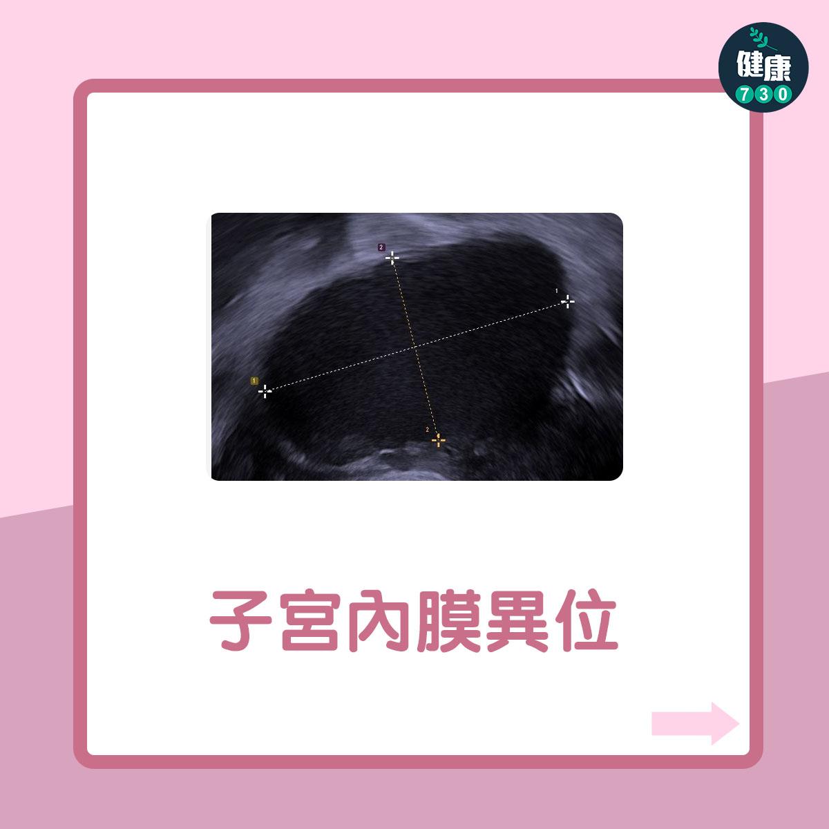 女性不育7大原因(am730製圖)