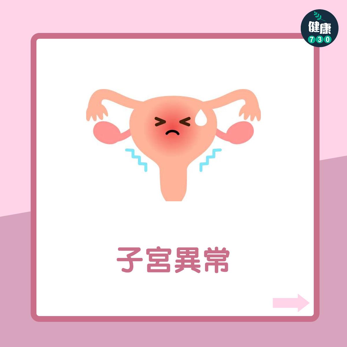 女性不育7大原因(am730製圖)