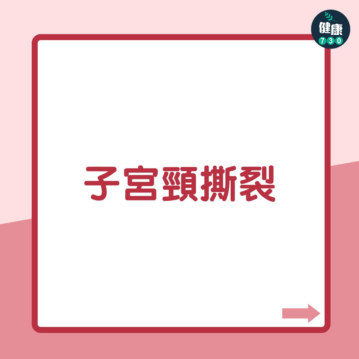 墮胎|終止懷孕後的影響(am730製圖)