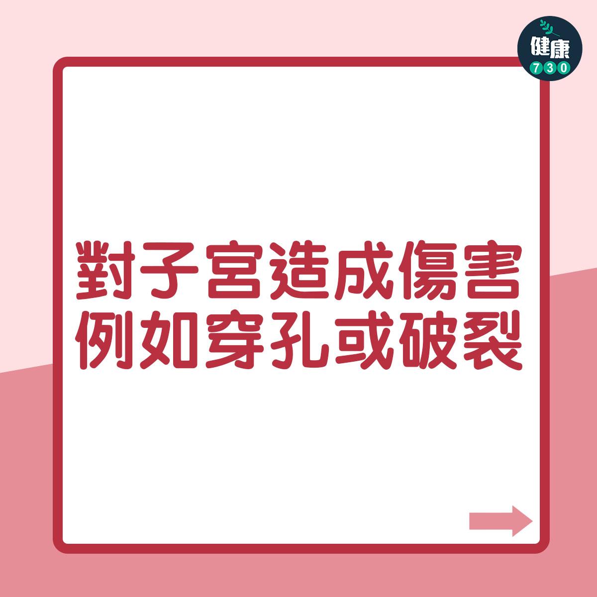 墮胎|終止懷孕後的影響(am730製圖)