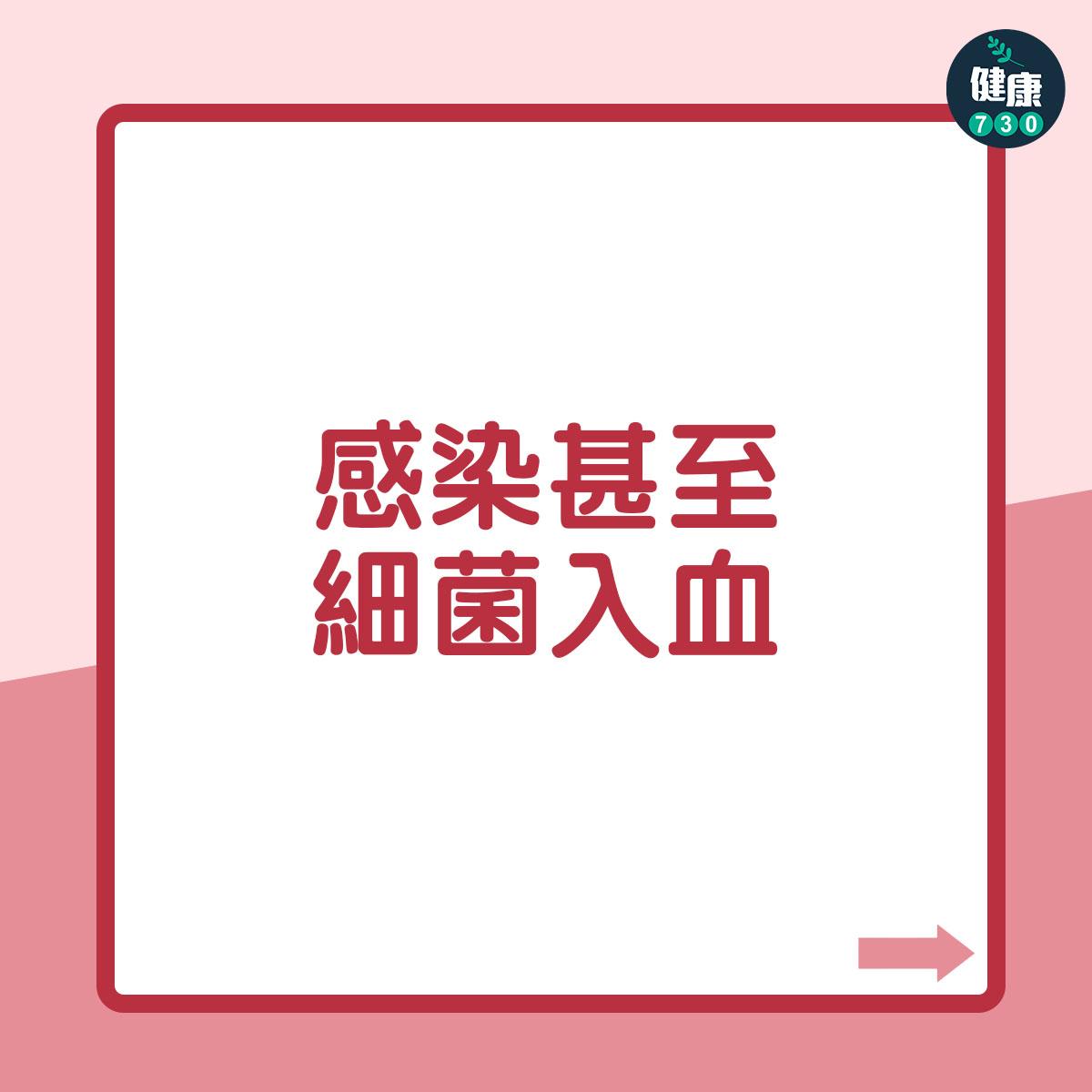 墮胎|終止懷孕後的影響(am730製圖)