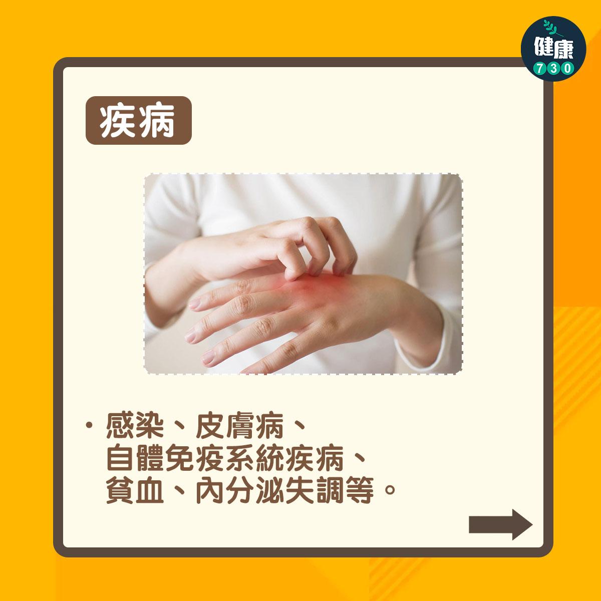 脫髮原因|頭髮稀疏有得救?(am730製圖)