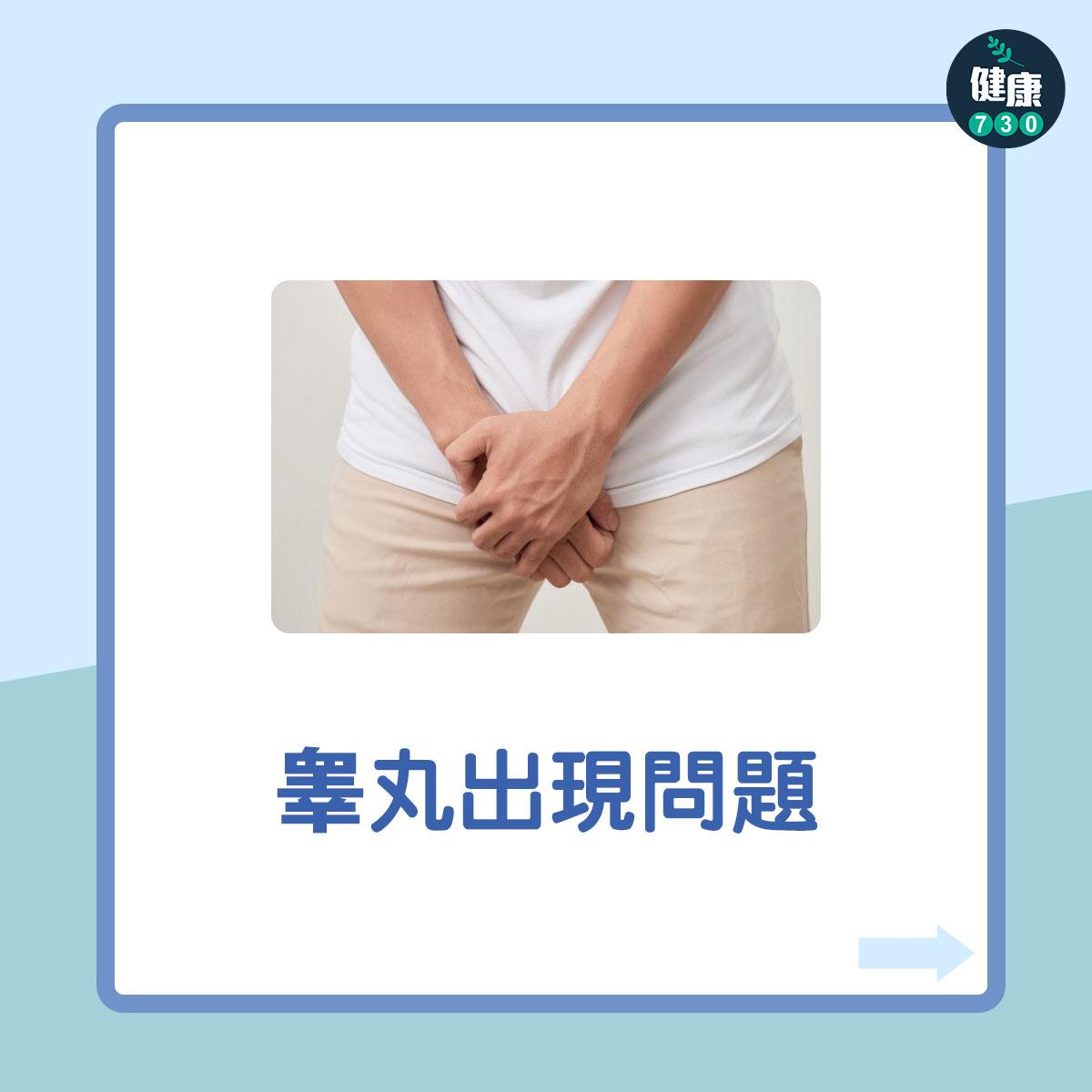 男性不育7大原因︰睾丸出現問題(am730製圖)