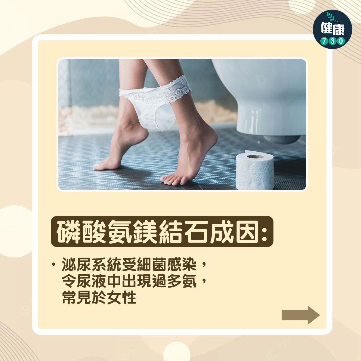 磷酸氨鎂結石成因: