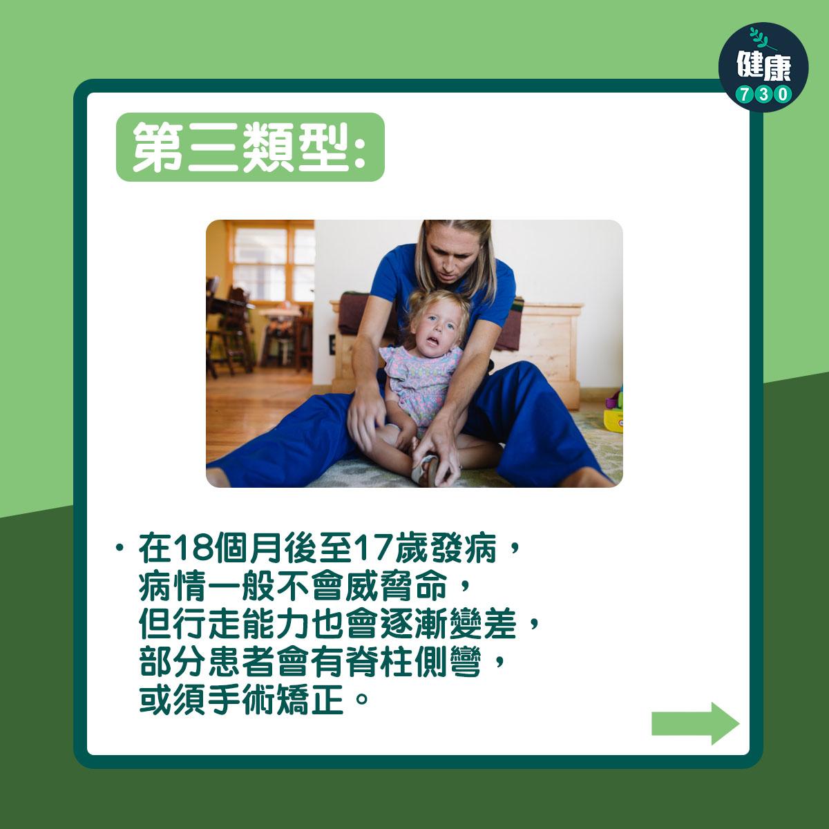 第三類型:在18個月後至17歲發病,病情一般不會威脅命,但行走能力也會逐漸變差,部分患者會有脊柱側彎,或須手術矯正。