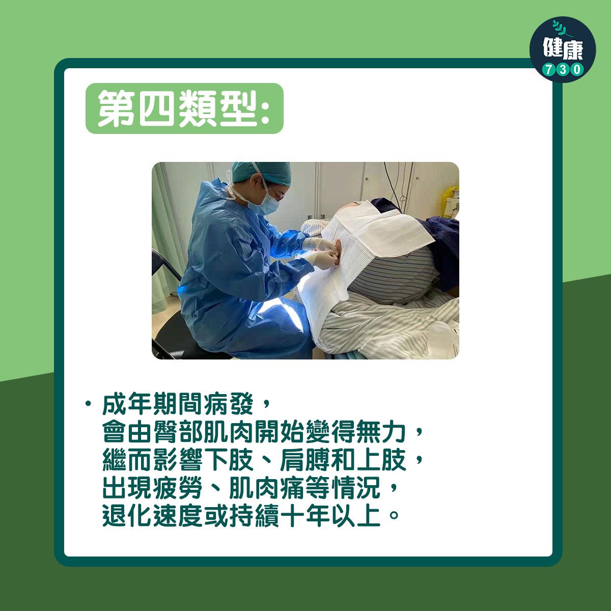 第四類型:成年期間病發,會由臀部肌肉開始變得無力,繼而影響下肢、肩膊和上肢,出現疲勞、肌肉痛等情況,退化速度或持續十年以上。