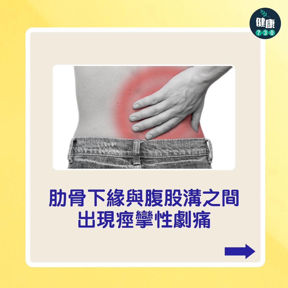 肋骨下緣與腹股溝之間出現痙攣性劇痛