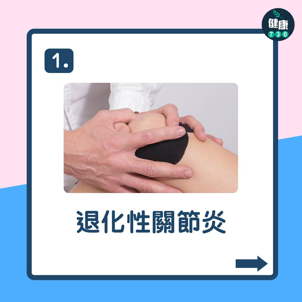 翹腳壞處|有機會導致退化性關節炎(am730製圖)