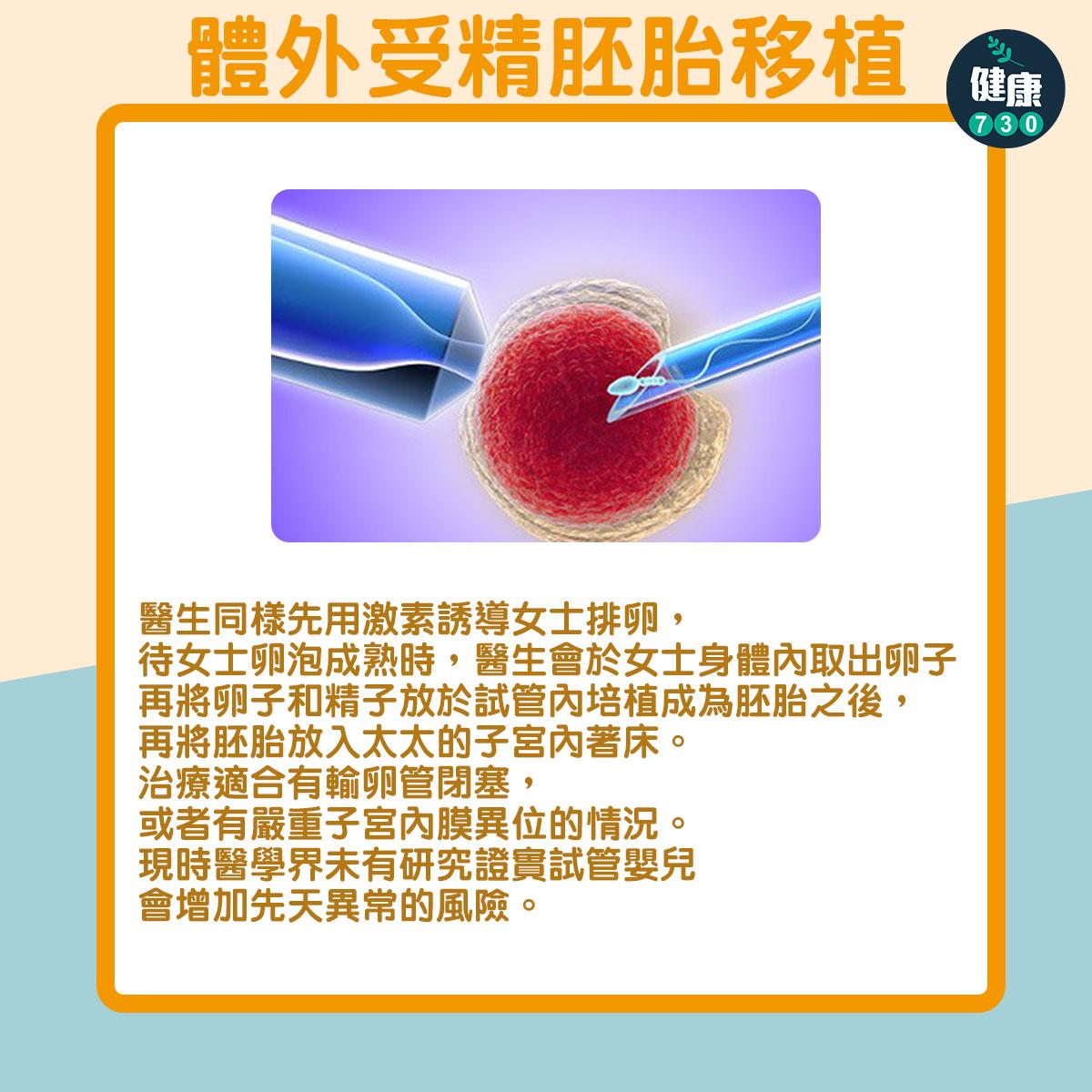 人工受孕方法:體外受精胚胎移植(am730製圖)