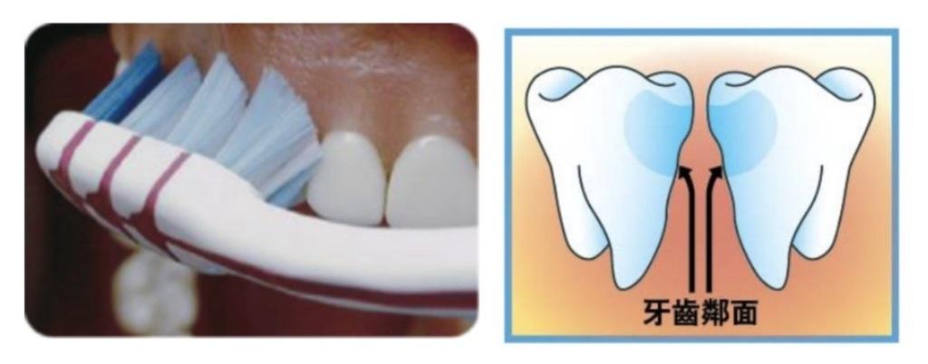 牙肉邊緣 / 牙縫間