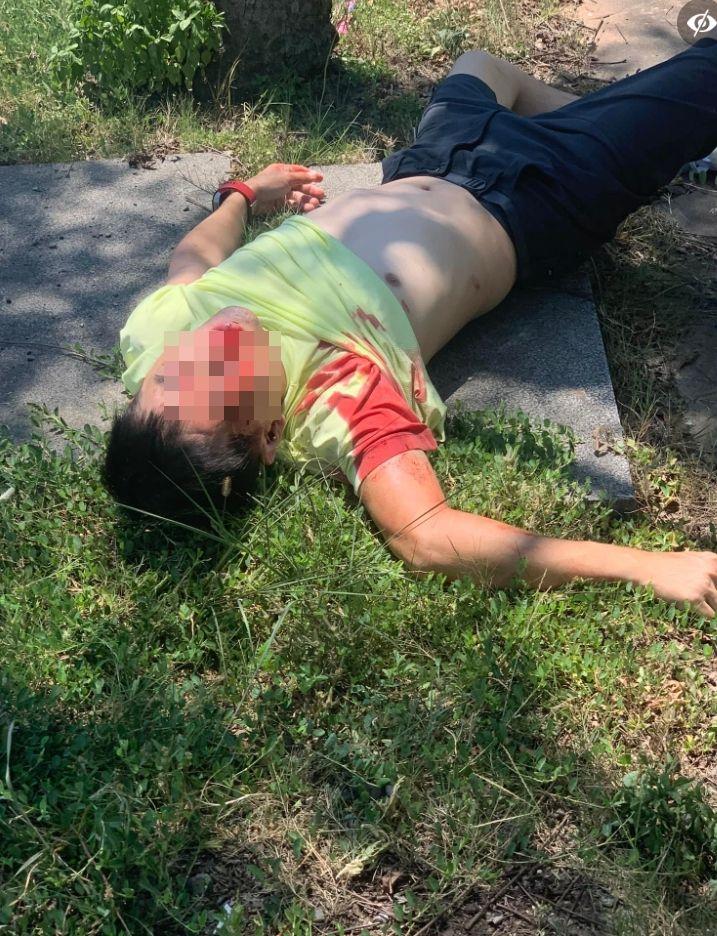 車禍受傷男子。照片翻攝自爆廢公社