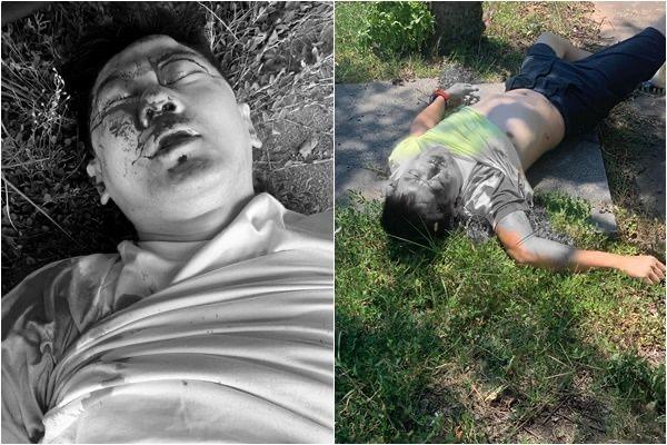 林志穎今日於台灣桃園市中心北路駕駛白色Tesla時自撞石壆,情況嚴重。